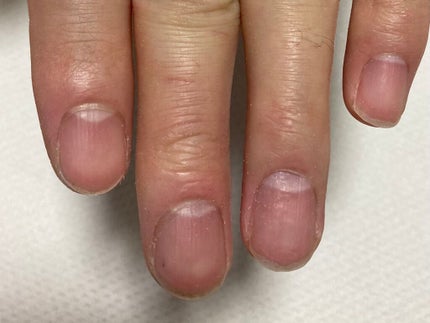 キューティクルリムーバー/BLUECROSS/ネイルオイル・トリートメントを使ったクチコミ(3枚目)