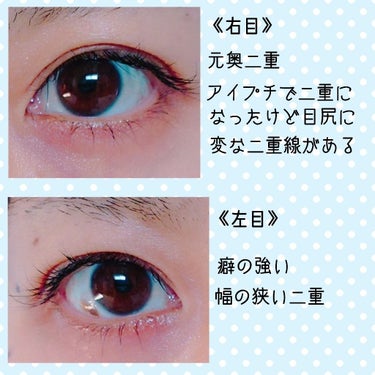 パワーアイリッドフィックス/Decorative Eyes/二重まぶた用アイテムを使ったクチコミ（2枚目）