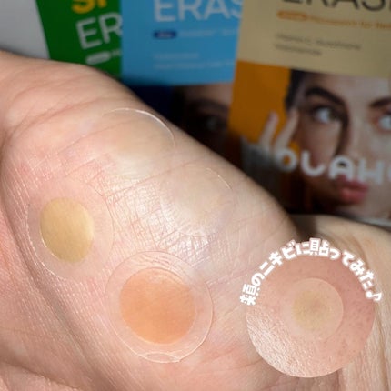 Kara on LIPS 「NOLAHOUR❤︎スポットイレイザー(グリーン)STEP1緑..」(5枚目)