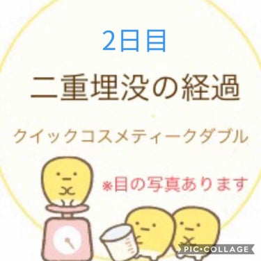 ぬこた on LIPS 「埋没2日目。まだ幅の広い二重な感じですが昨日よりは目のつっぱり..」（1枚目）