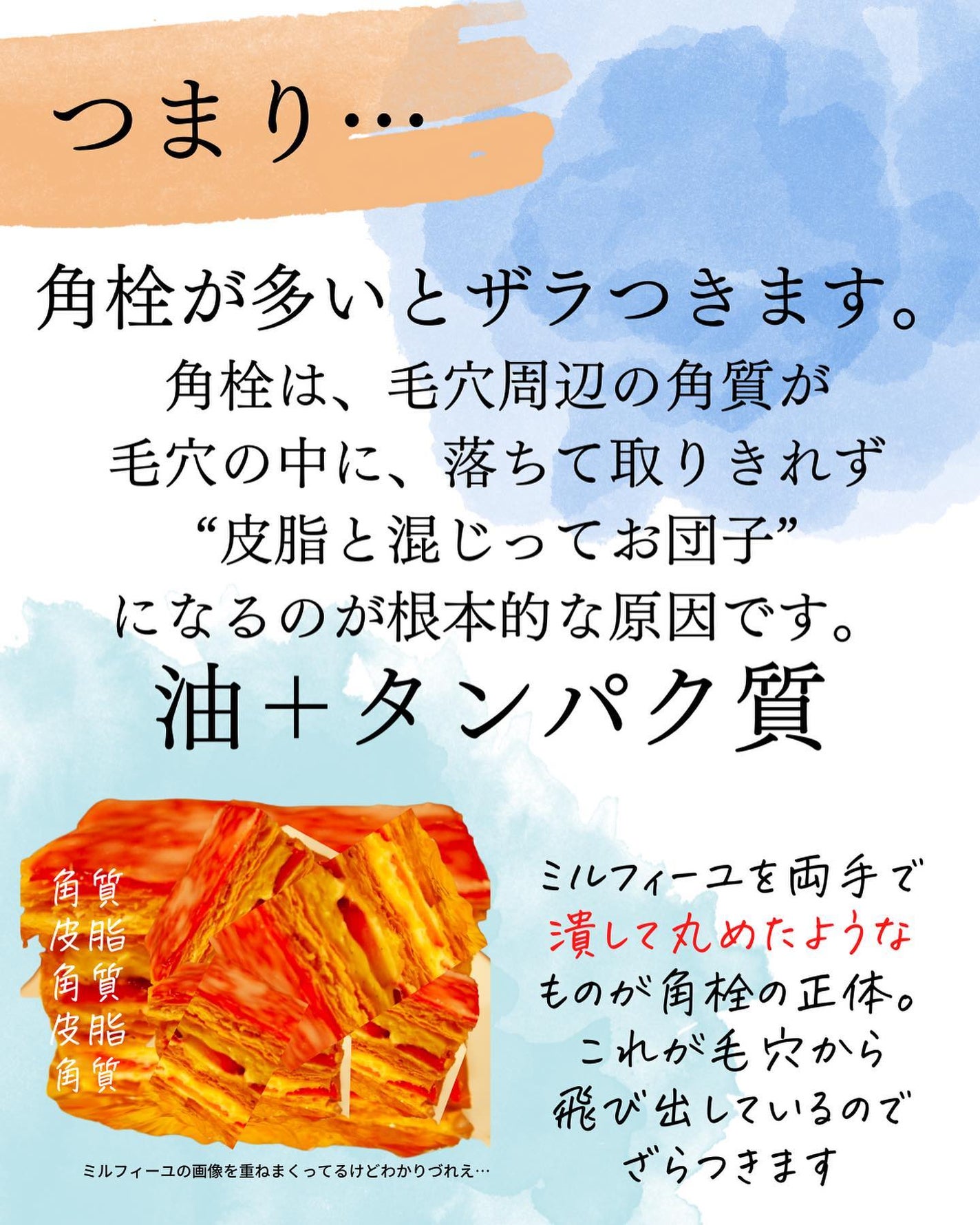 おゆみ|ニキビ・ニキビ跡ケア on LIPS 「@______ohyoume◀︎他の投稿はこちらから💄【手洗い..」(4枚目)