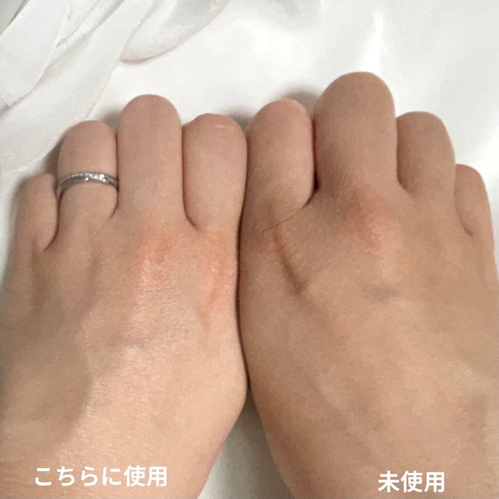 UVã€ã㢠XL ãããã¯ã·ã§ã³ããŒã³ã¢ãã ããŒãº/ã© ããã·ã¥ ããŒ/æ¥çŒãæ¢ãã¯ãªãŒã ã䜿ã£ãã¯ãã³ãïŒ3æç®ïŒ