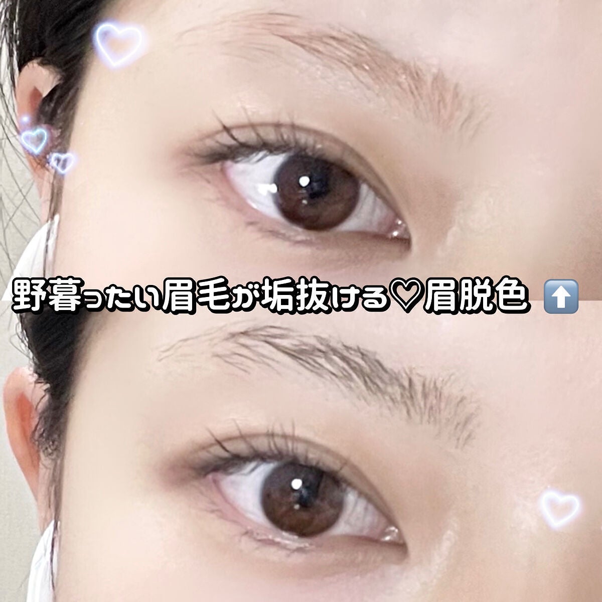 脱色クリーム 敏感肌用/エピラット/ムダ毛ケアを使ったクチコミ(1枚目)