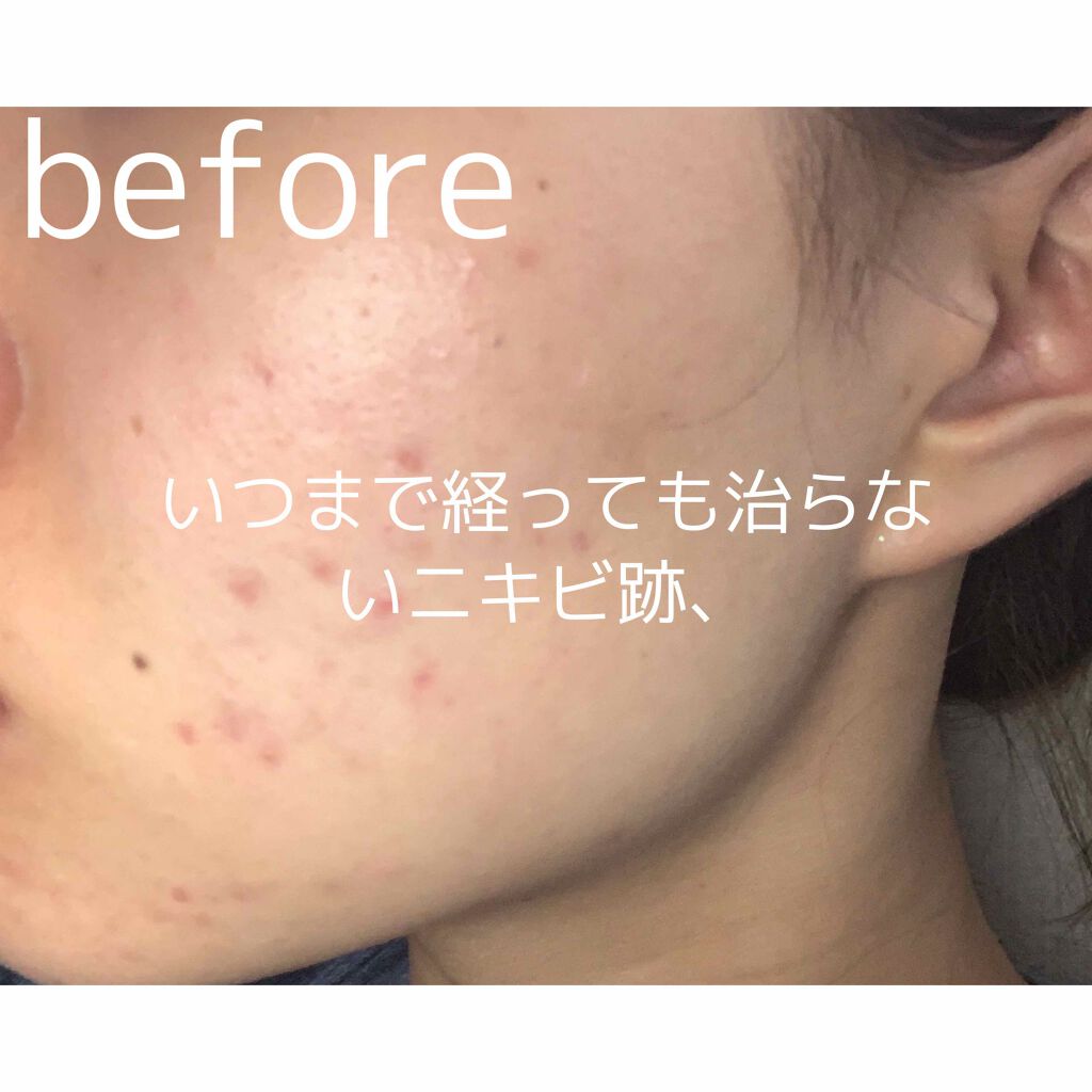 M クッション ファンデーション(モイスチャー)/MISSHA/クッションファンデーションを使ったクチコミ（2枚目）