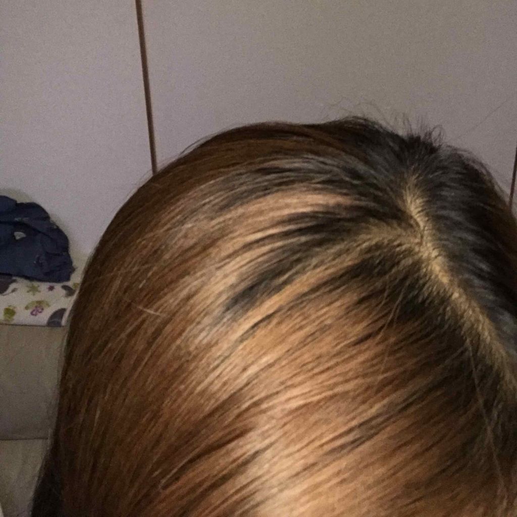 ホイップヘアカラー 髪色もどし ビューティラボの辛口レビュー ビューティーラボホイップヘアカラー髪色戻し By しらす 普通肌 10代後半 Lips