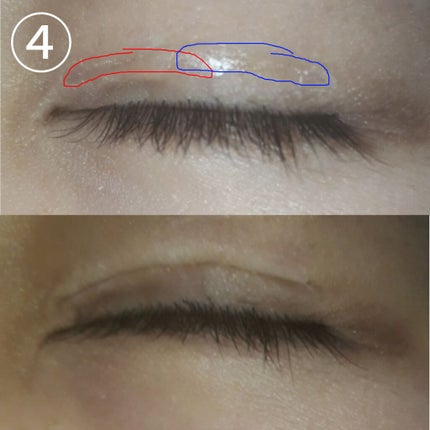 アイテープ 埋没式両面テープ/DAISO/二重まぶた用アイテムを使ったクチコミ(3枚目)