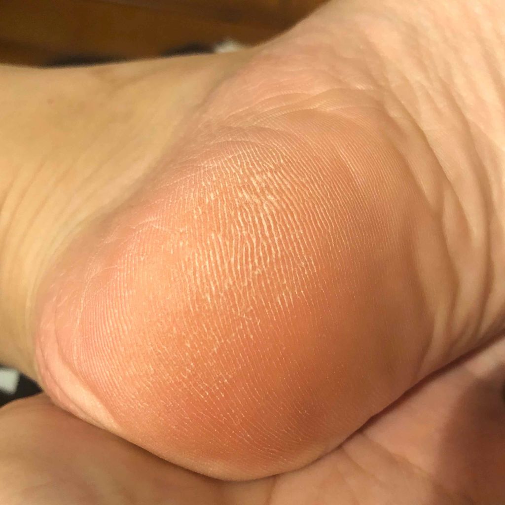 ニベアクリーム/ニベア/ボディクリームを使ったクチコミ（3枚目）