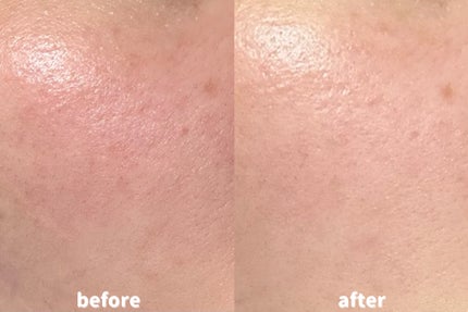 エクソソームシカ アンプル/MEDICUBE/美容液を使ったクチコミ(2枚目)