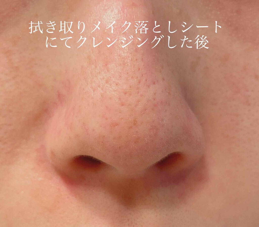 ミセラークレンジングシート セラムモイスト/ビフェスタ/クレンジングシートを使ったクチコミ（3枚目）