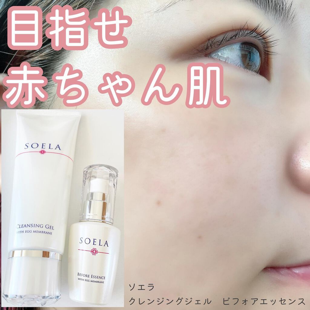 ビフォアエッセンス/SOELA/美容液を使ったクチコミ（1枚目）