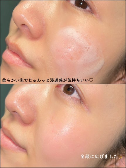 バイタルイミュンショットファーストバブルセラム/SKIN SIGNAL/美容液を使ったクチコミ(5枚目)