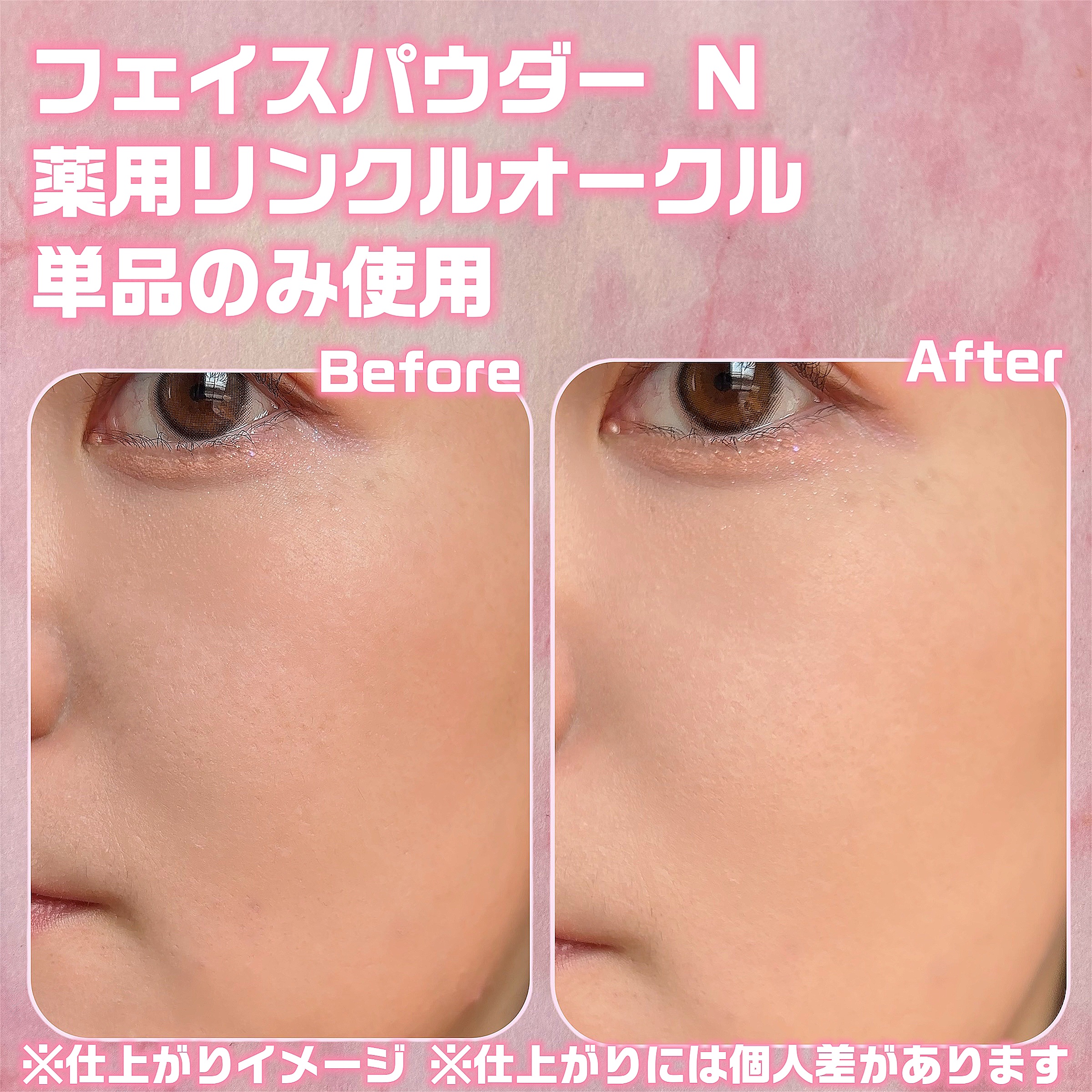 フェイスパウダー N 薬用リンクルオークル/クリアラスト/プレストパウダーを使ったクチコミ（3枚目）