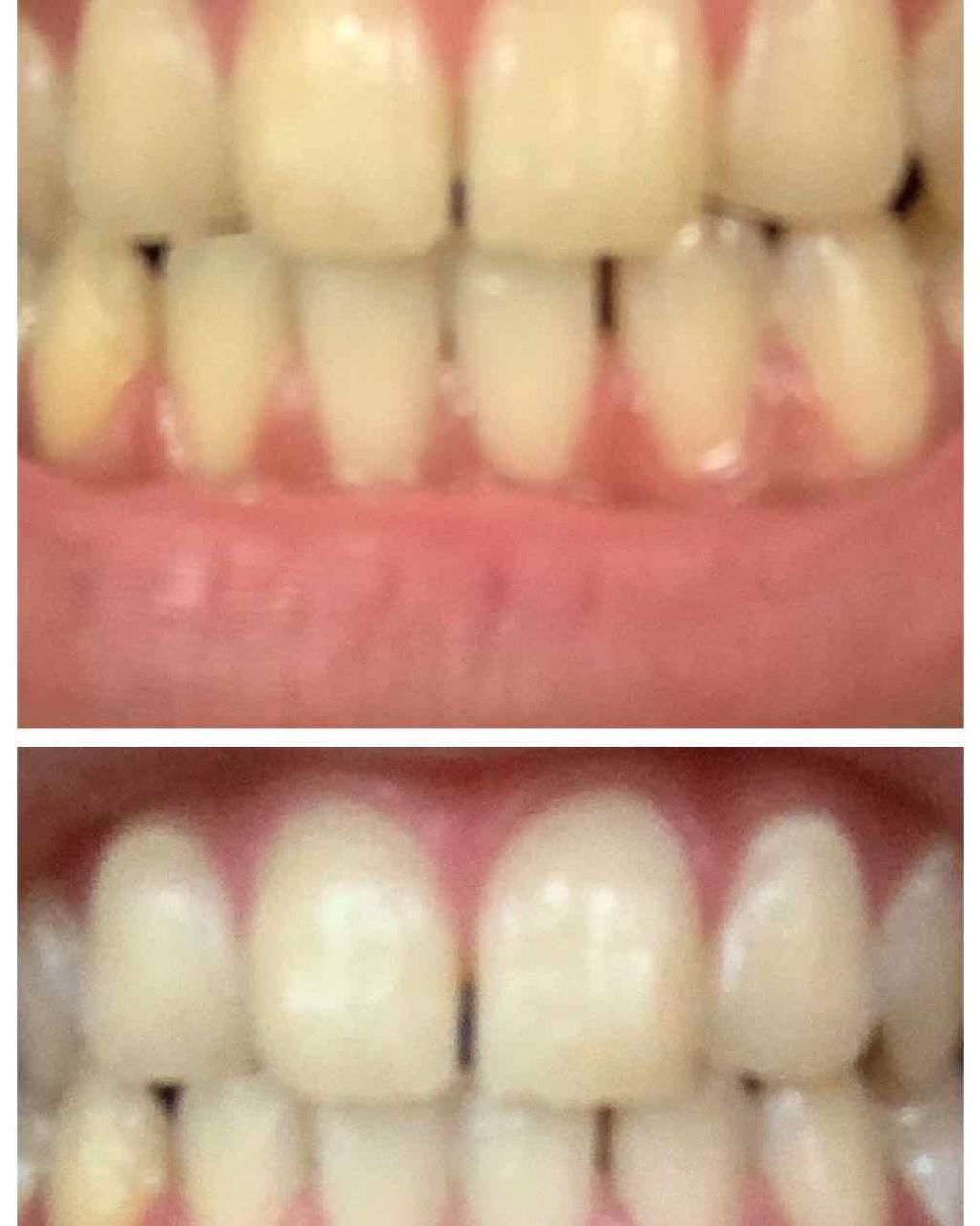 重曹つるつるハミガキ/歯磨撫子/歯磨き粉を使ったクチコミ（2枚目）