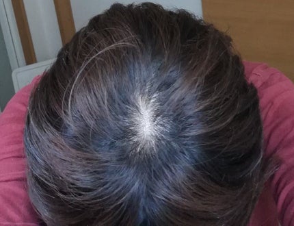 カラートリートメント/サイオス/ヘアカラーを使ったクチコミ(2枚目)