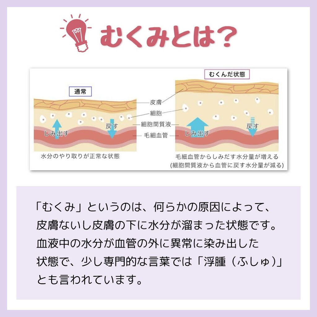 アミュレスリム 着圧レギンス/EMICLEAIR/着圧ソックス・レギンスを使ったクチコミ(2枚目)