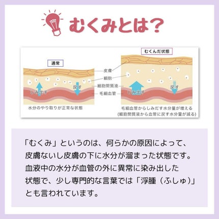 アミュレスリム 着圧レギンス/EMICLEAIR/着圧ソックス・レギンスを使ったクチコミ(2枚目)