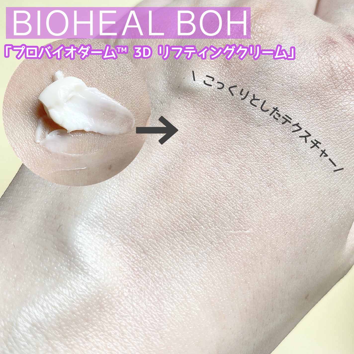 バイオヒールボ プロバイオダーム 3Dリフティングクリーム/BIOHEAL BOH/フェイスクリームを使ったクチコミ(5枚目)