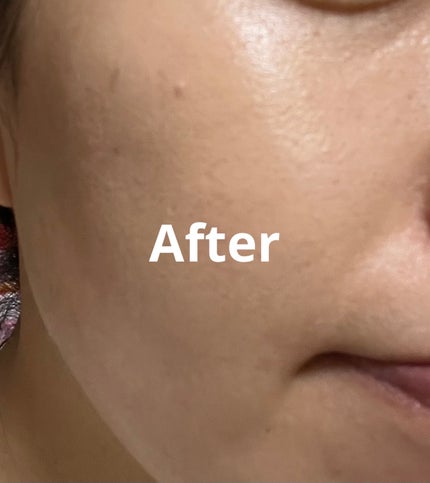 アイレノール クマクリーム/IRENOL/アイケア・アイクリームを使ったクチコミ(4枚目)