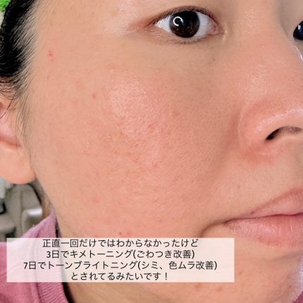 グルタ ビタミンC トーニング アンプル/IOPE/美容液を使ったクチコミ(7枚目)