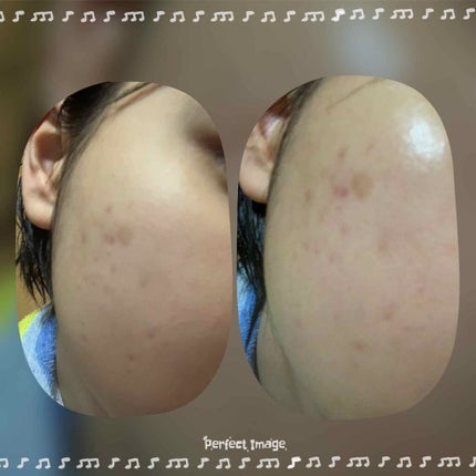 スキンケアパウダー/素肌記念日/プレストパウダーを使ったクチコミ(1枚目)