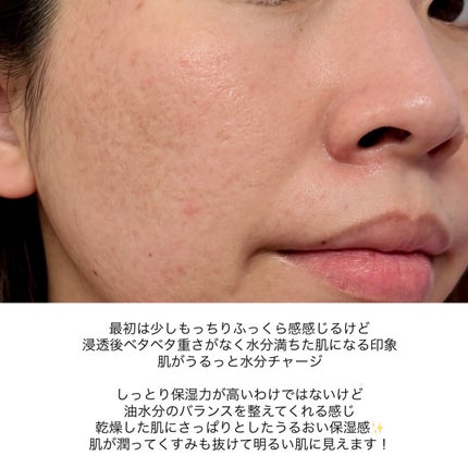 グルタチオンナイアシンアミド シートマスク/APLB/シートマスク・パックを使ったクチコミ(7枚目)