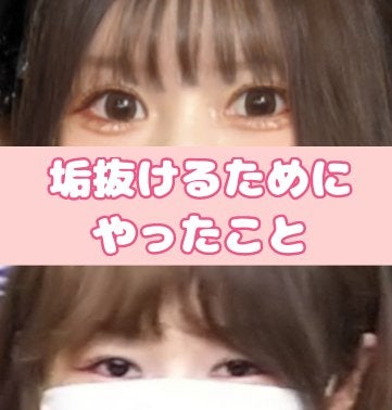 らぃちる on LIPS 「目のサイズも目つきも変わった私的垢抜け方法※目のサイズ加工整形..」(1枚目)