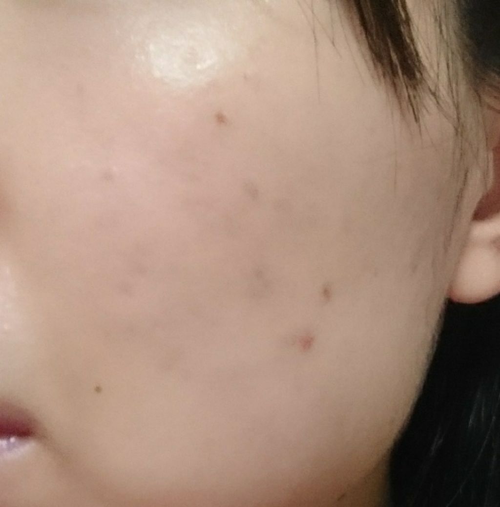 プロポリス エネルギーアンプル/CNP Laboratory/美容液を使ったクチコミ(2枚目)