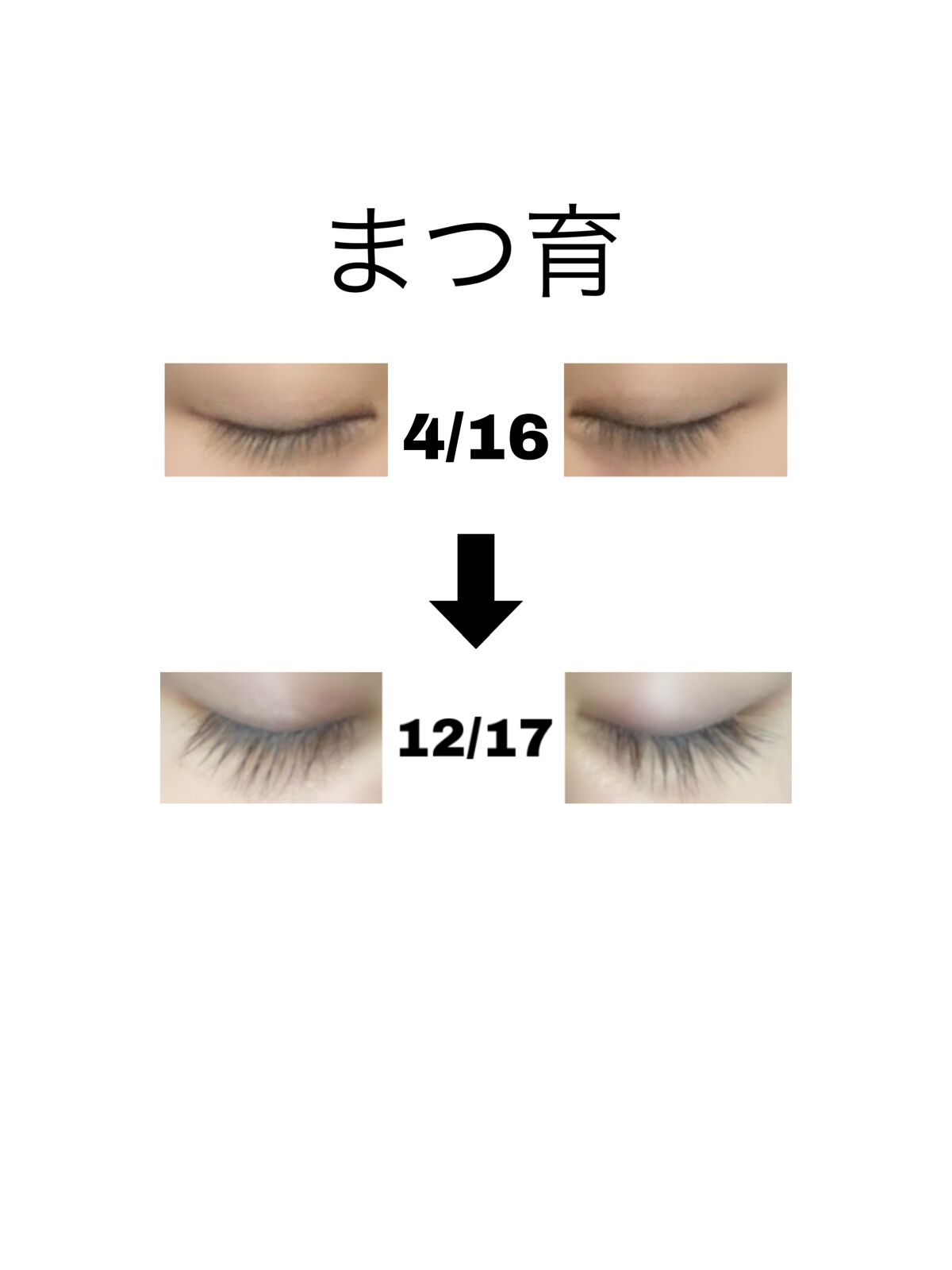 EMAKED(エマーキット)|水橋保寿堂製薬の効果に関する口コミ EMAKED(エマーキット)|水橋保寿堂製薬の効果に関する口コミ
