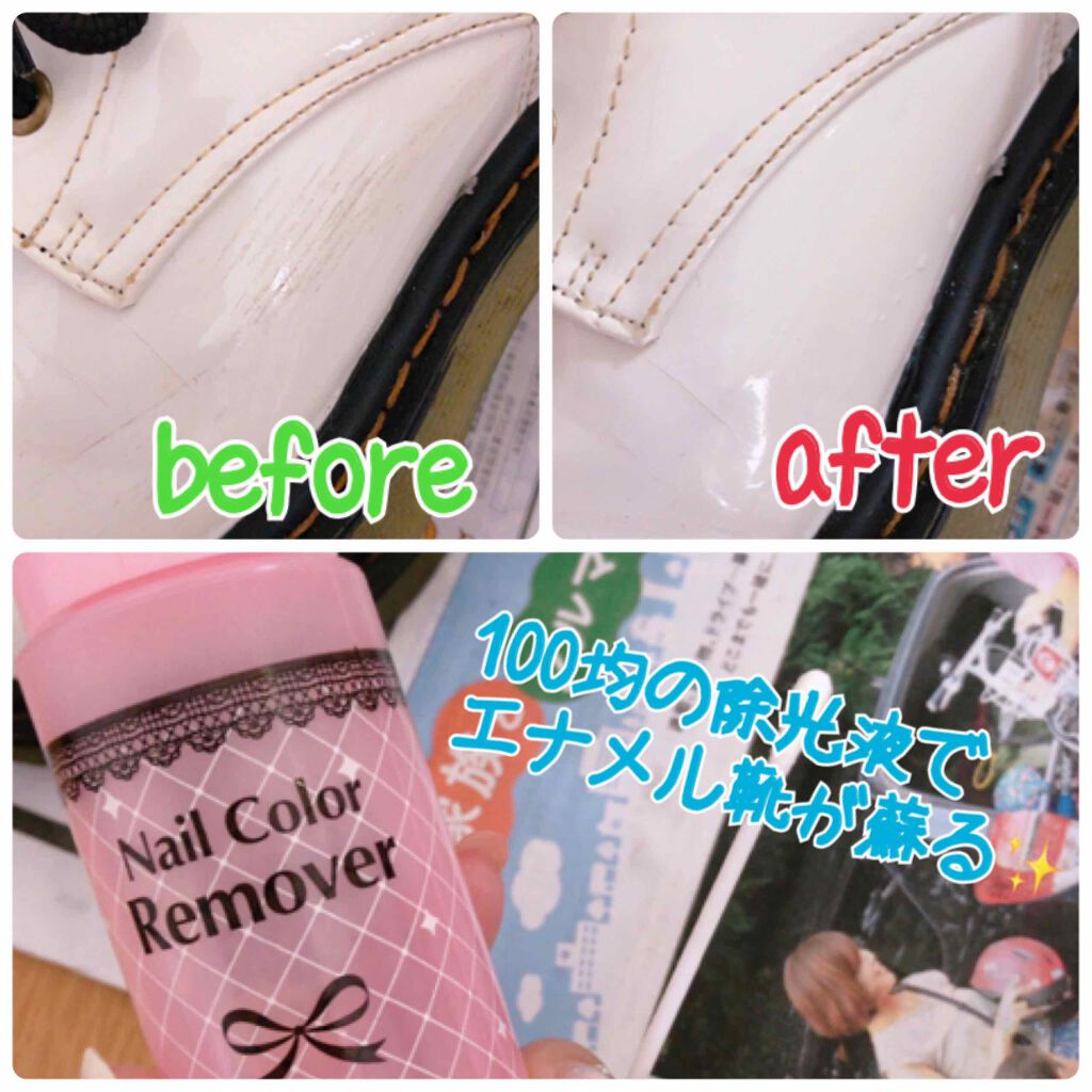 ネイルリムーバー ラズベリーの香り/DAISO/除光液を使ったクチコミ(1枚目)