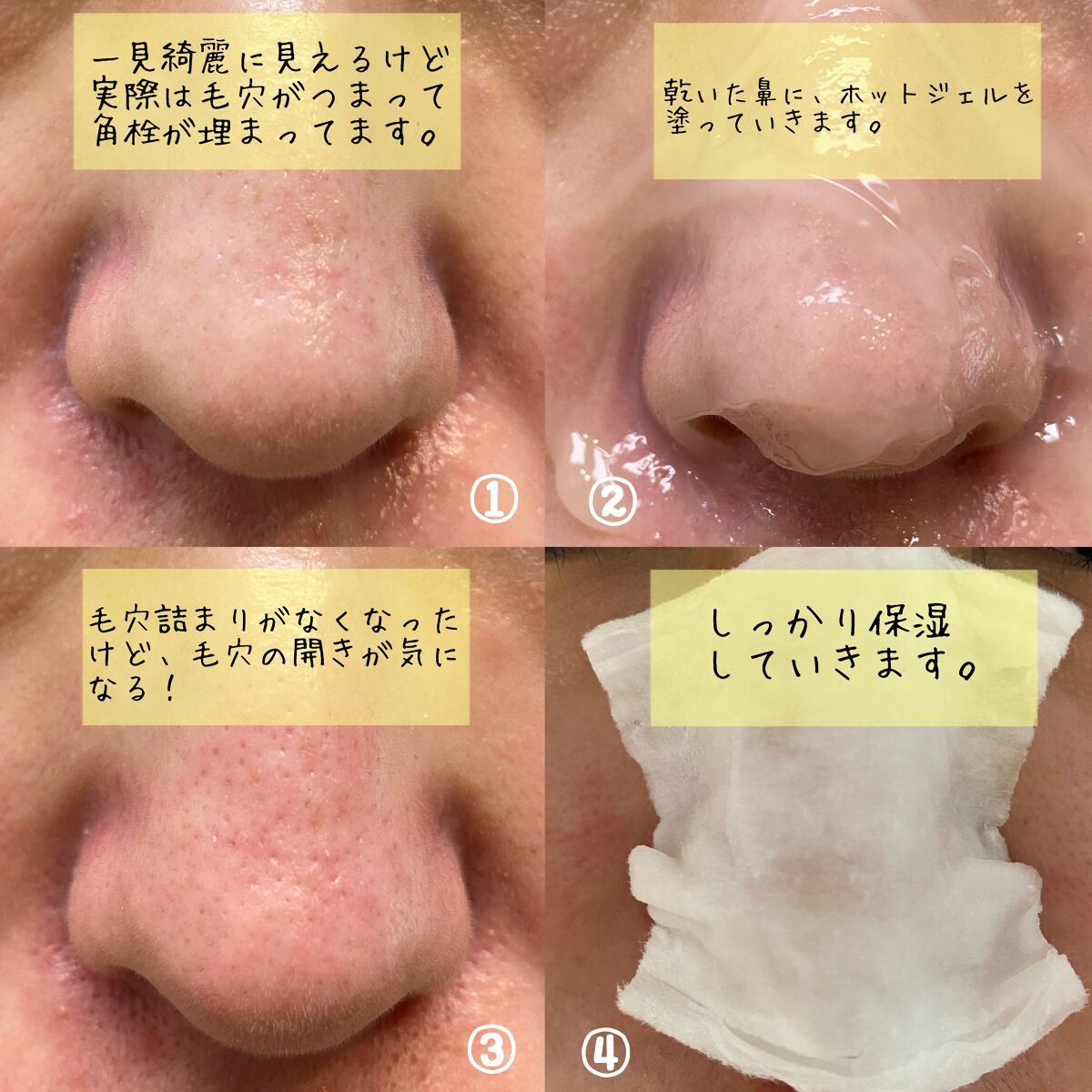 マイルドホットクレンジングジェル/Auna/クレンジングジェルを使ったクチコミ(5枚目)