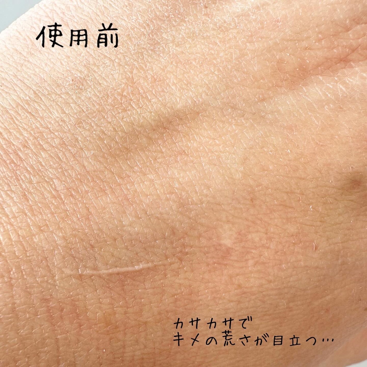 PDRNピンクアンプル PDRN 10,000ppm配合/MEDICUBE/美容液を使ったクチコミ(4枚目)