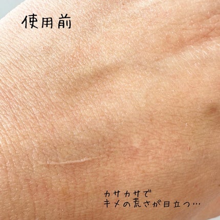 PDRNピンクアンプル PDRN 10,000ppm配合/MEDICUBE/美容液を使ったクチコミ(4枚目)