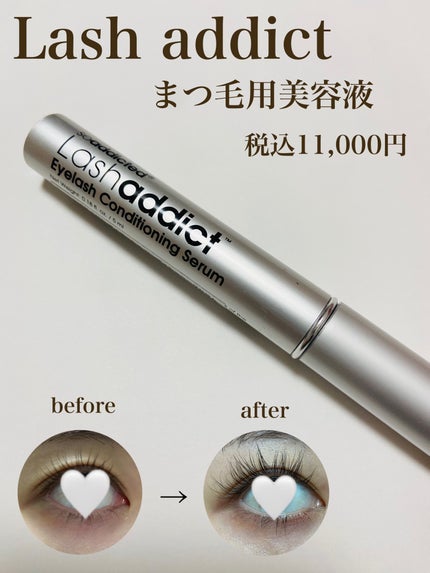 ラッシュアディクト アイラッシュコンディショニングセラム/soaddicted/まつげ美容液を使ったクチコミ(1枚目)
