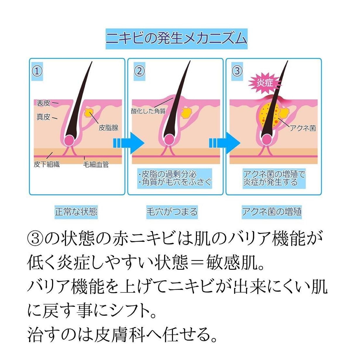 試してみた】アクネグラン 薬用 クリーミー ウォッシュ ナリス化粧品の
