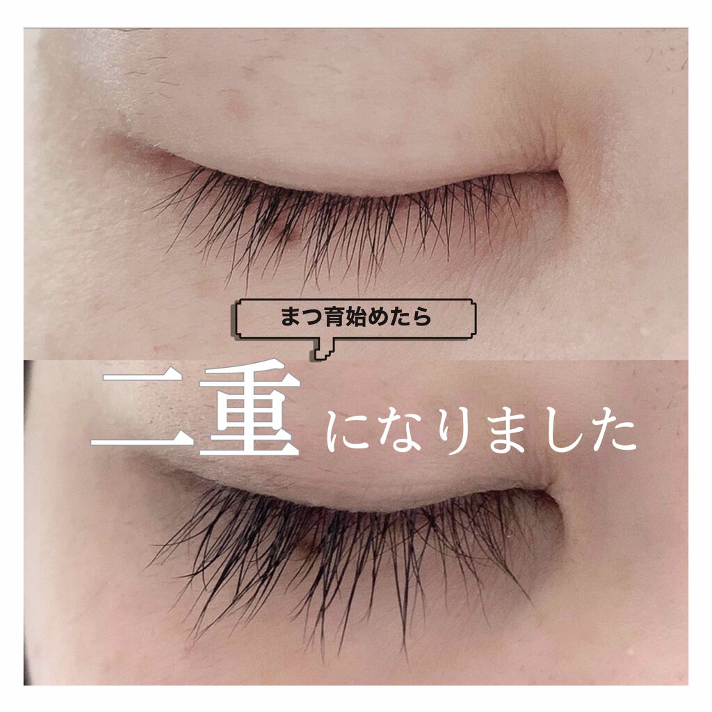 Emaked 水橋保寿堂製薬の使い方を徹底解説 生まれつきガチ一重の私がまつ育始めたら二 By 𝐑𝐈𝐇𝐎 混合肌 代後半 Lips