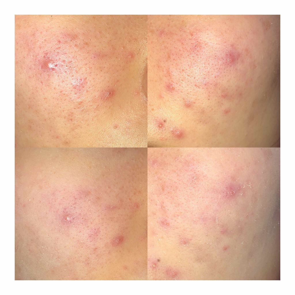 メイクアップベースS(グリーン)/media/化粧下地を使ったクチコミ(1枚目)