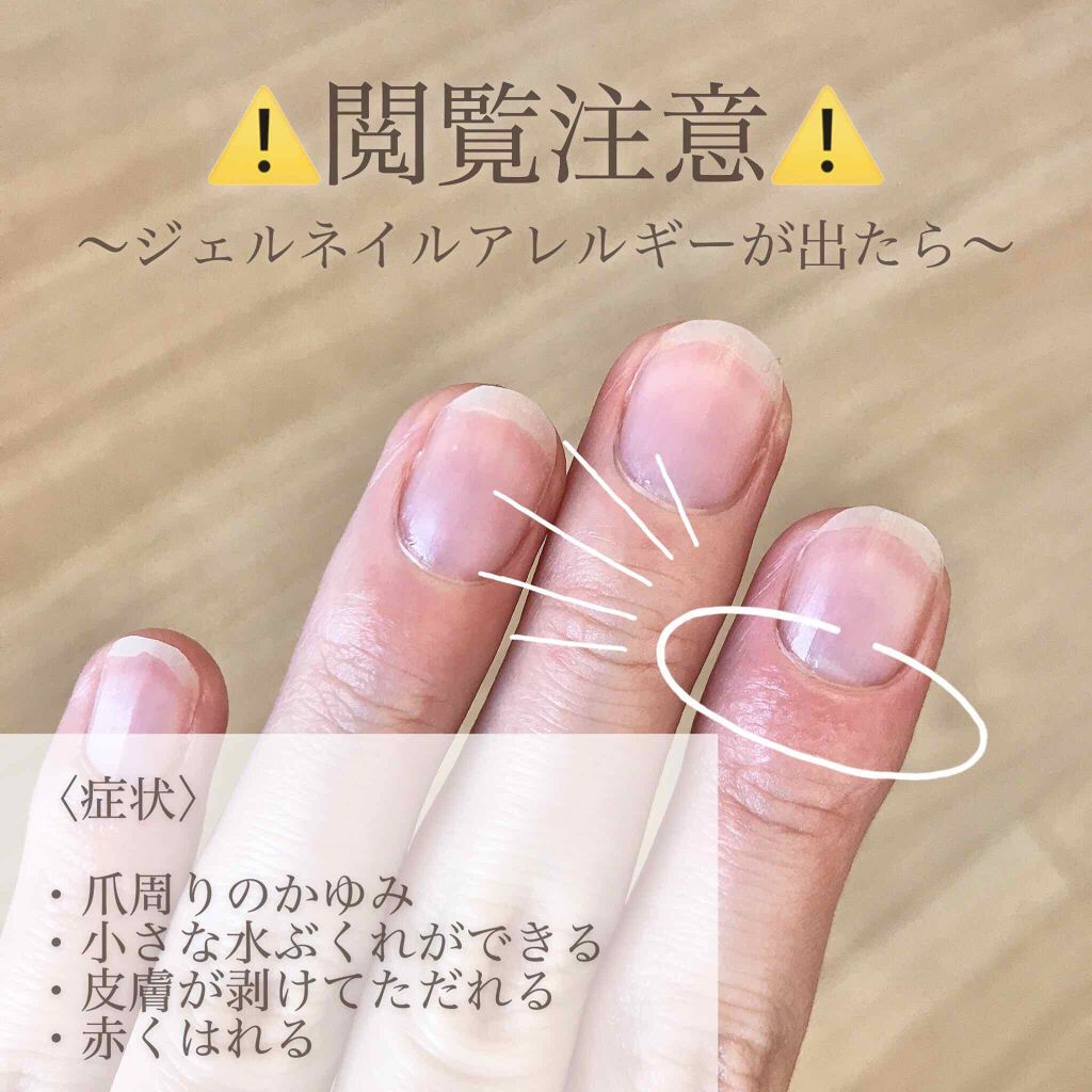 ジェルネイル（ライト対応）/セリア/ジェルネイルを使ったクチコミ（3枚目）