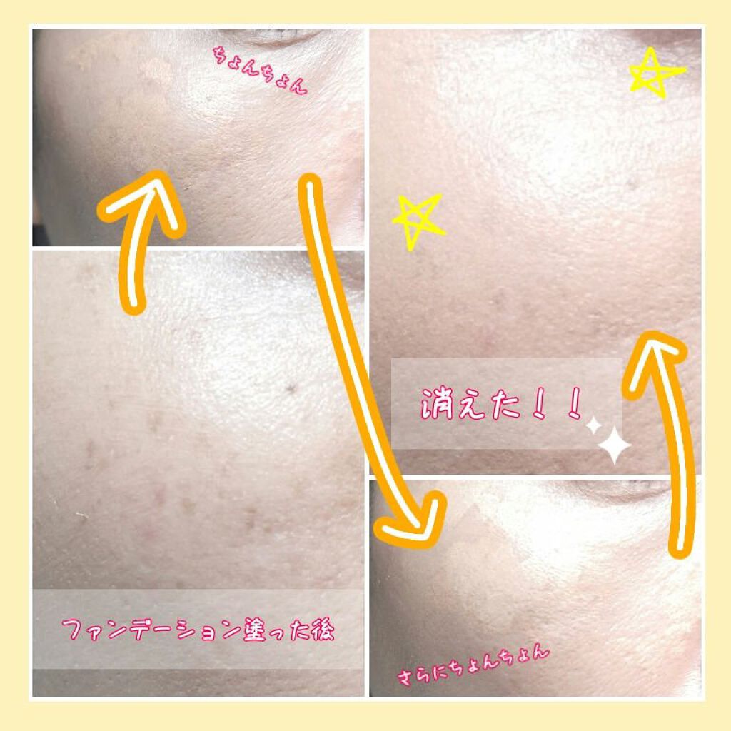 カラーミキシングコンシーラー/キャンメイク/パレットコンシーラーを使ったクチコミ(2枚目)