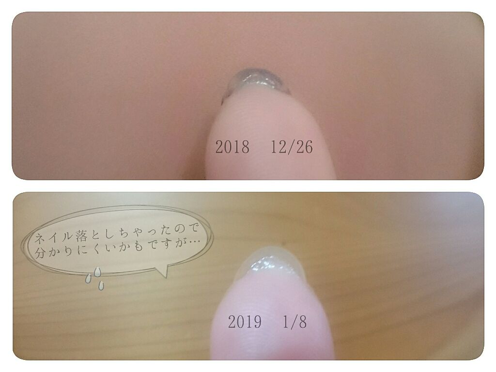 オリジナル ピュアスキンジェリー/ヴァセリン/ボディクリームを使ったクチコミ（3枚目）