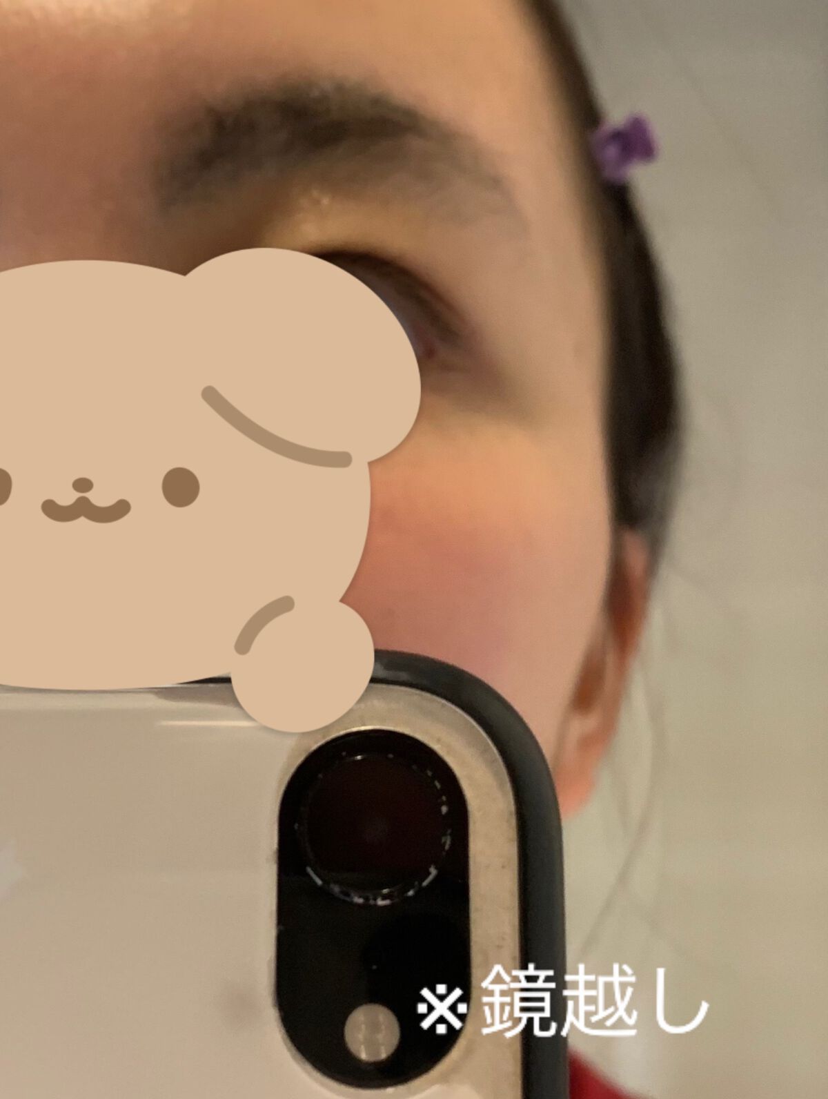 光美容器KE-NON(ケノン)/エムテック/家庭用脱毛器を使ったクチコミ(3枚目)