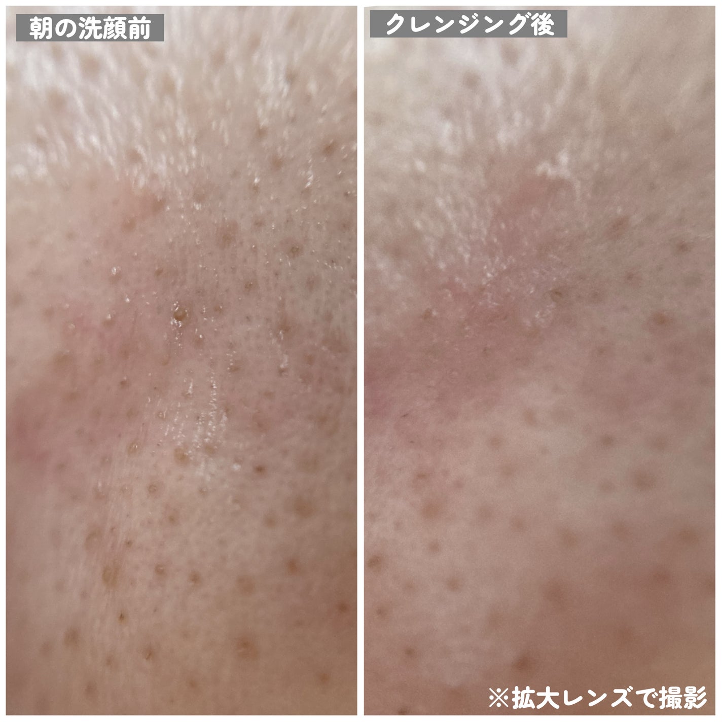 ポアクリア オイル/ONE BY KOSE/オイルクレンジングを使ったクチコミ(8枚目)