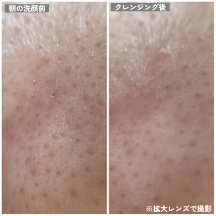 ポアクリア オイル/ONE BY KOSE/オイルクレンジングを使ったクチコミ(8枚目)
