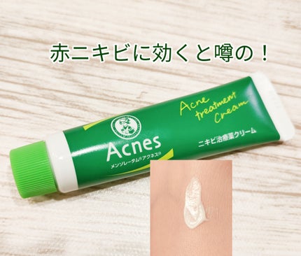 ニキビ治療薬(医薬品)/メンソレータム アクネス/その他を使ったクチコミ(1枚目)