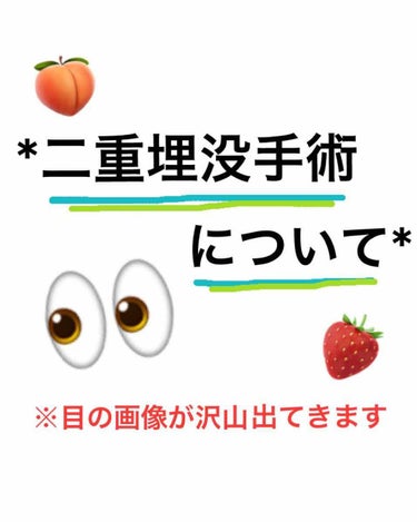 ⚠︎二枚目以降、目の画像がたくさん出てきます⚠︎

今回は二重整形(埋没)についてお話したいと思います❀

私は今年の7月末に城本クリニックで埋没手術をしてきました！
費用は両目8万程で、5年か8年保証