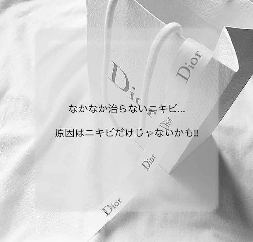 アクアチムローション、アクアチムクリーム(医薬品)/大塚製薬/その他を使ったクチコミ（1枚目）