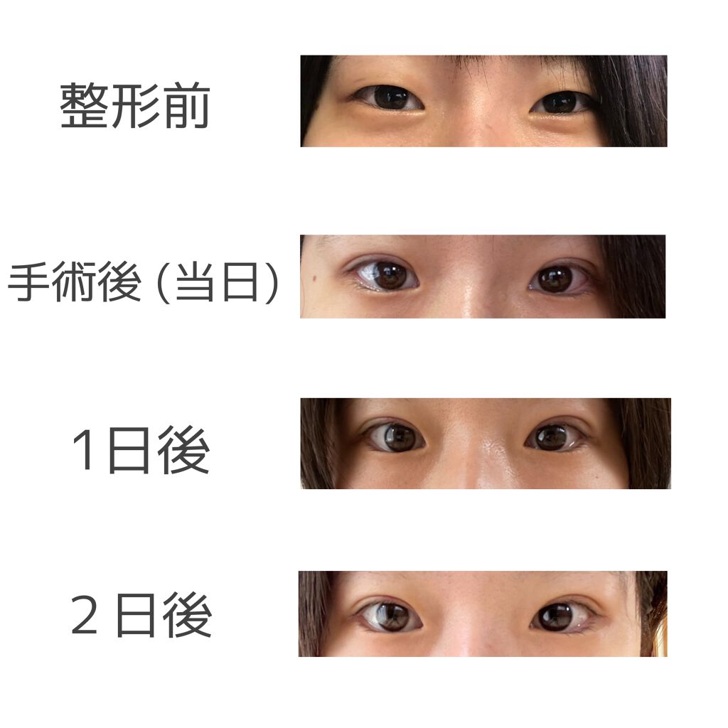 みー on LIPS 「こんにちは!初めて投稿するので、読みづらかったらごめんなさい🙇..」(1枚目)