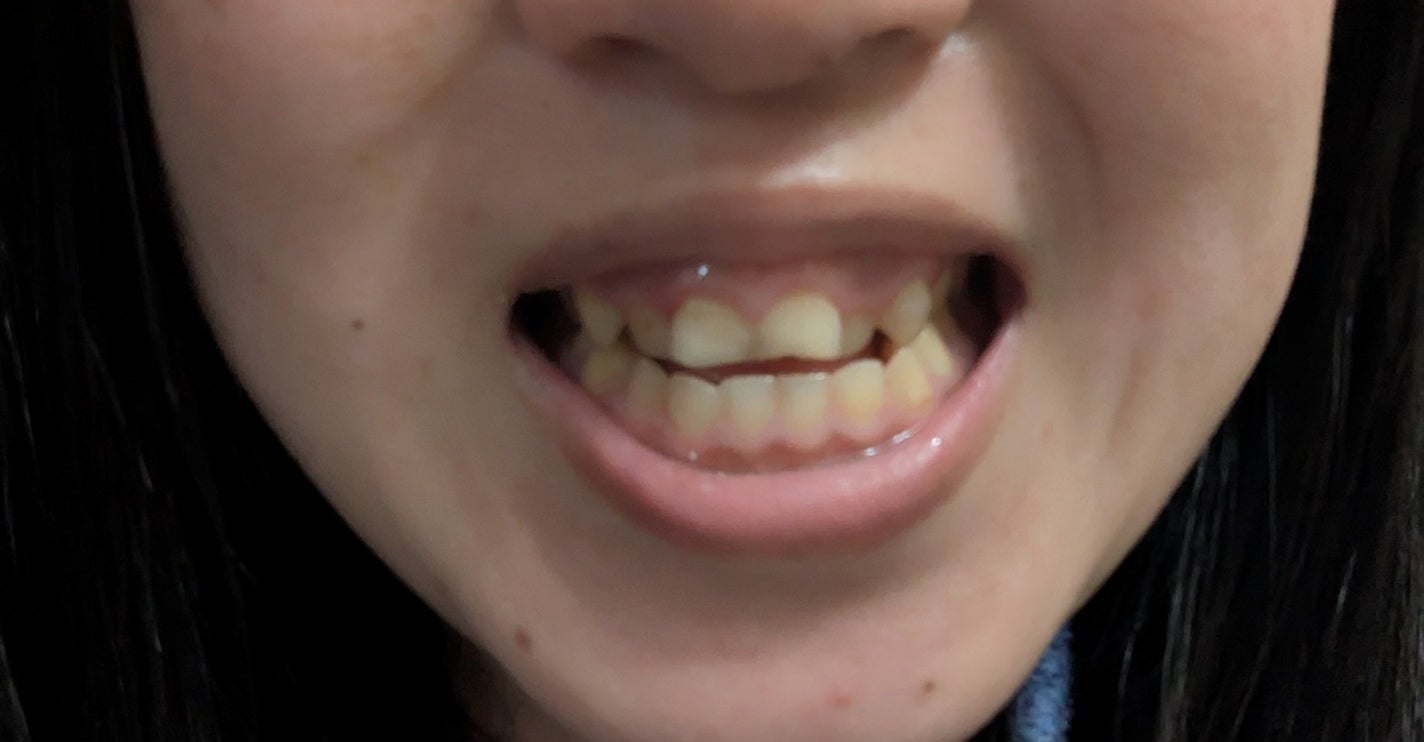 ビュッセン 歯磨き粉 28  /VUSSEN/歯磨き粉を使ったクチコミ(2枚目)