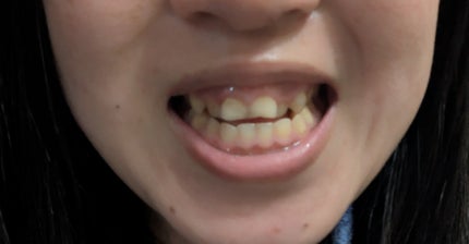 ビュッセン 歯磨き粉 28  /VUSSEN/歯磨き粉を使ったクチコミ(2枚目)