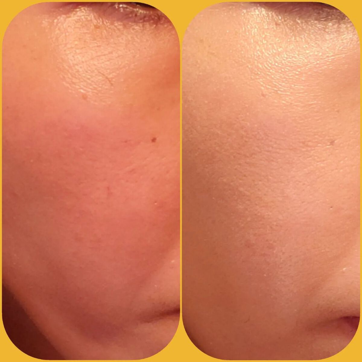 フローレス ルミエール ラディアンス パーフェクティング クッション/ローラ メルシエ/クッションファンデーションを使ったクチコミ(4枚目)