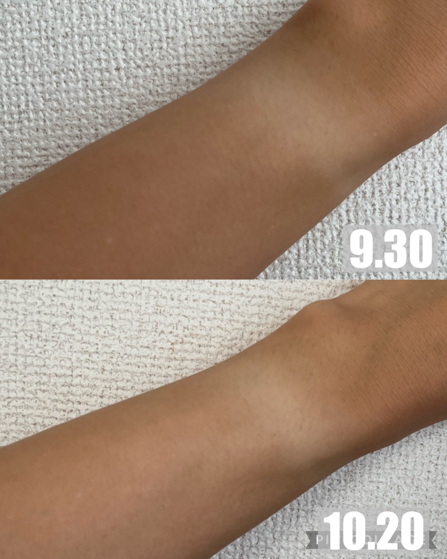 グルタチオン ホワイトサプリ/calmfort/美容サプリメントを使ったクチコミ(3枚目)